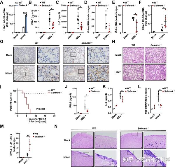 Plos Pathog︱山东大学贾木天 赵伟团队揭示硒蛋白调控sting激活新机制 知乎