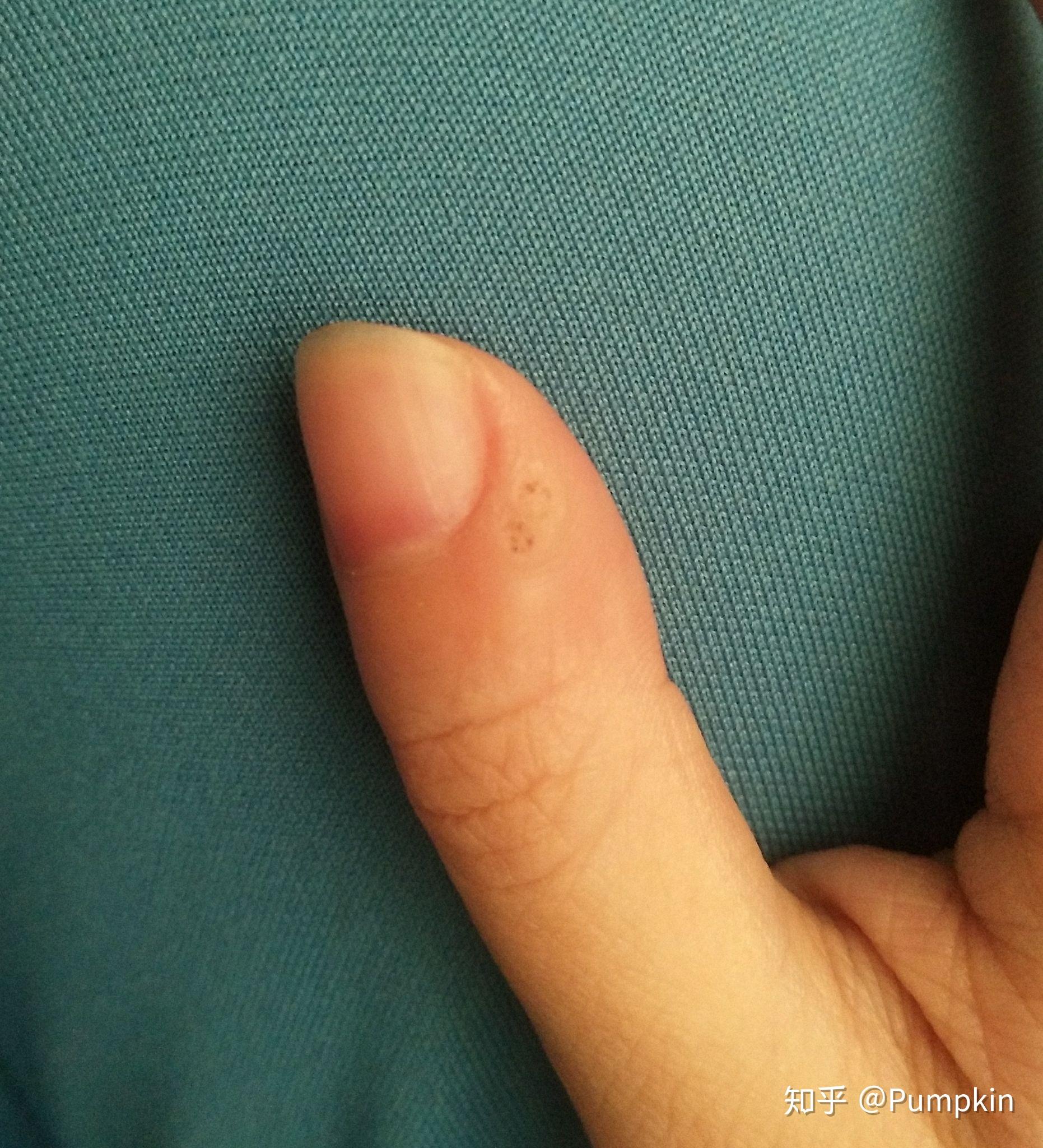 开始了我的敷醋体验…最后安利了米醋然后真的是翻了很多就没买了怕