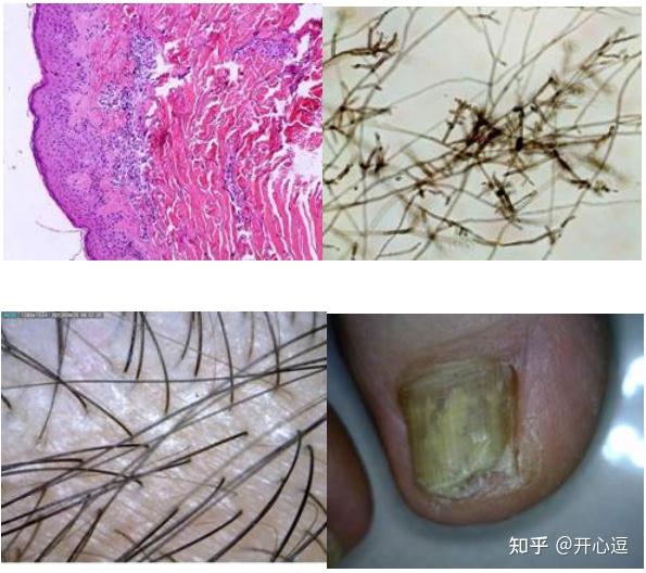 江苏省捷达科技发展有限公司皮肤真菌镜检分析系统