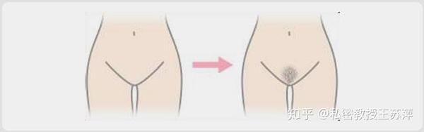 女性阴毛都有什么作用 知乎