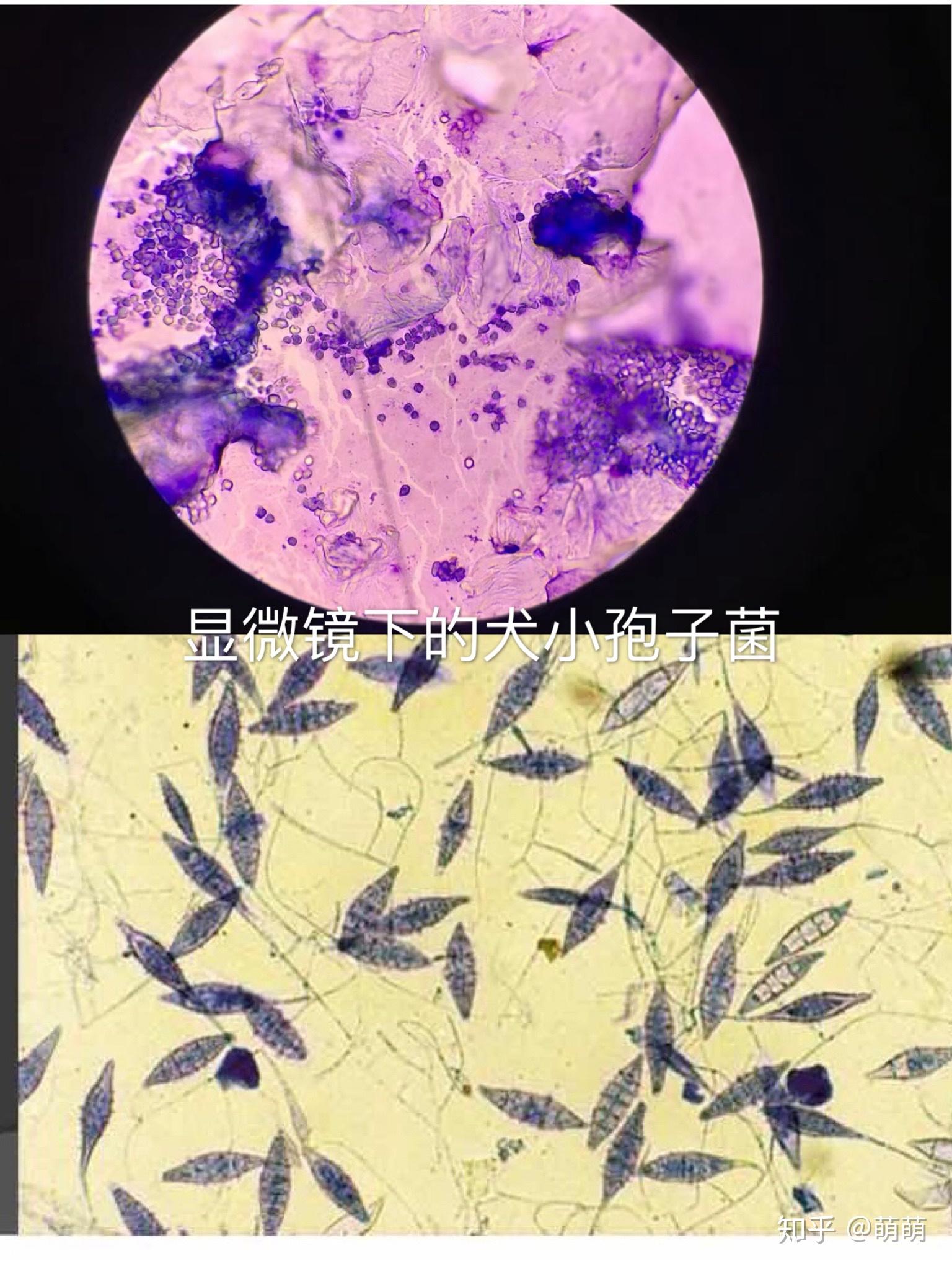 真菌孢子图片 显微镜图片