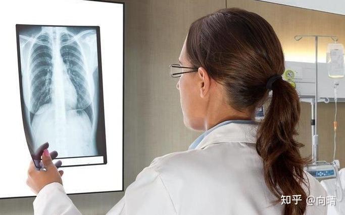 19岁女生体检拍x光片被男医生要求脱光上衣警方称没有违法