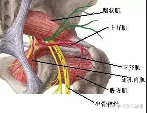 3 股二頭肌:病變後可卡壓坐骨神經4 膕肌:損傷可刺激脛神經5 比目魚