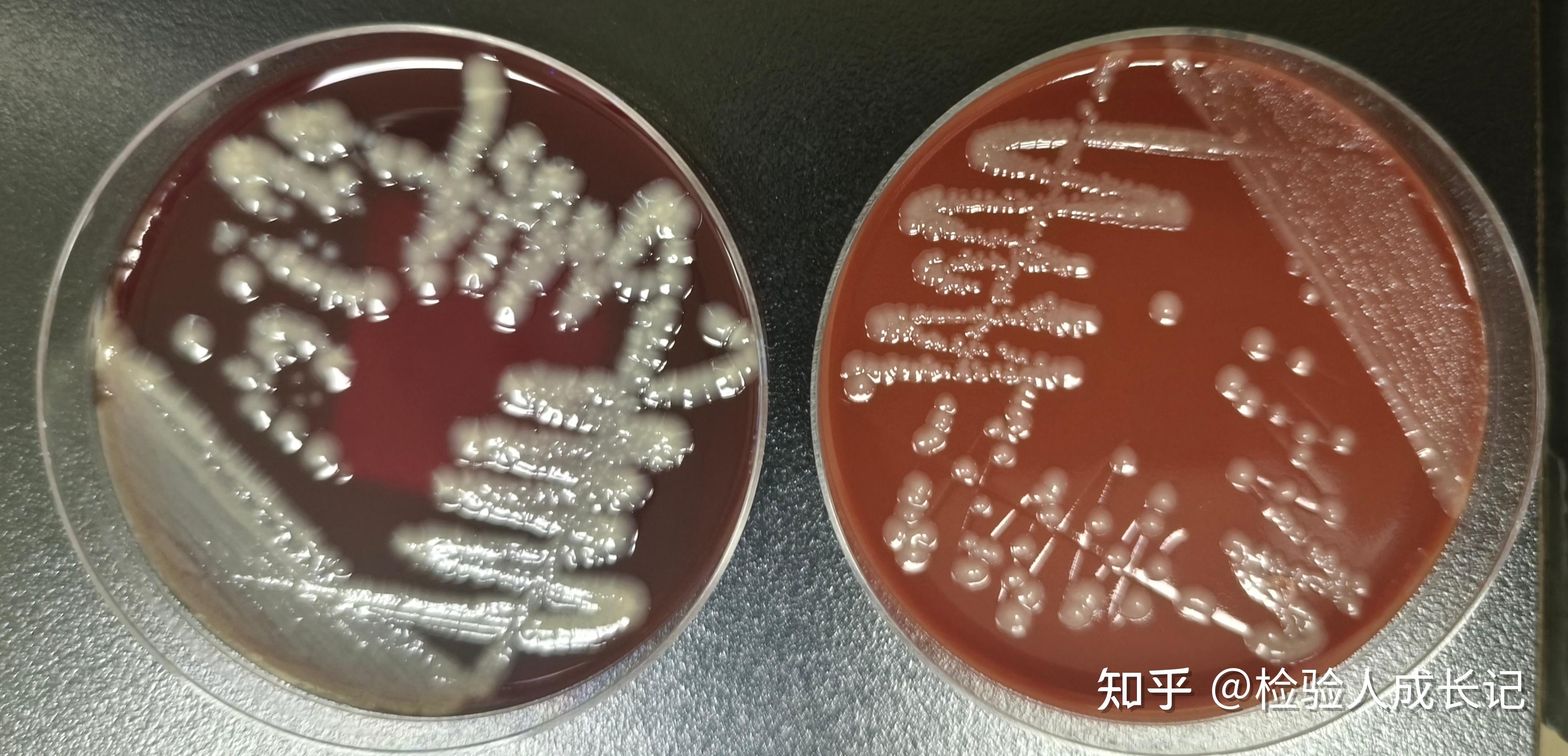 检验规培成长记-微生物检验之培养基菌落的观察 - 知乎