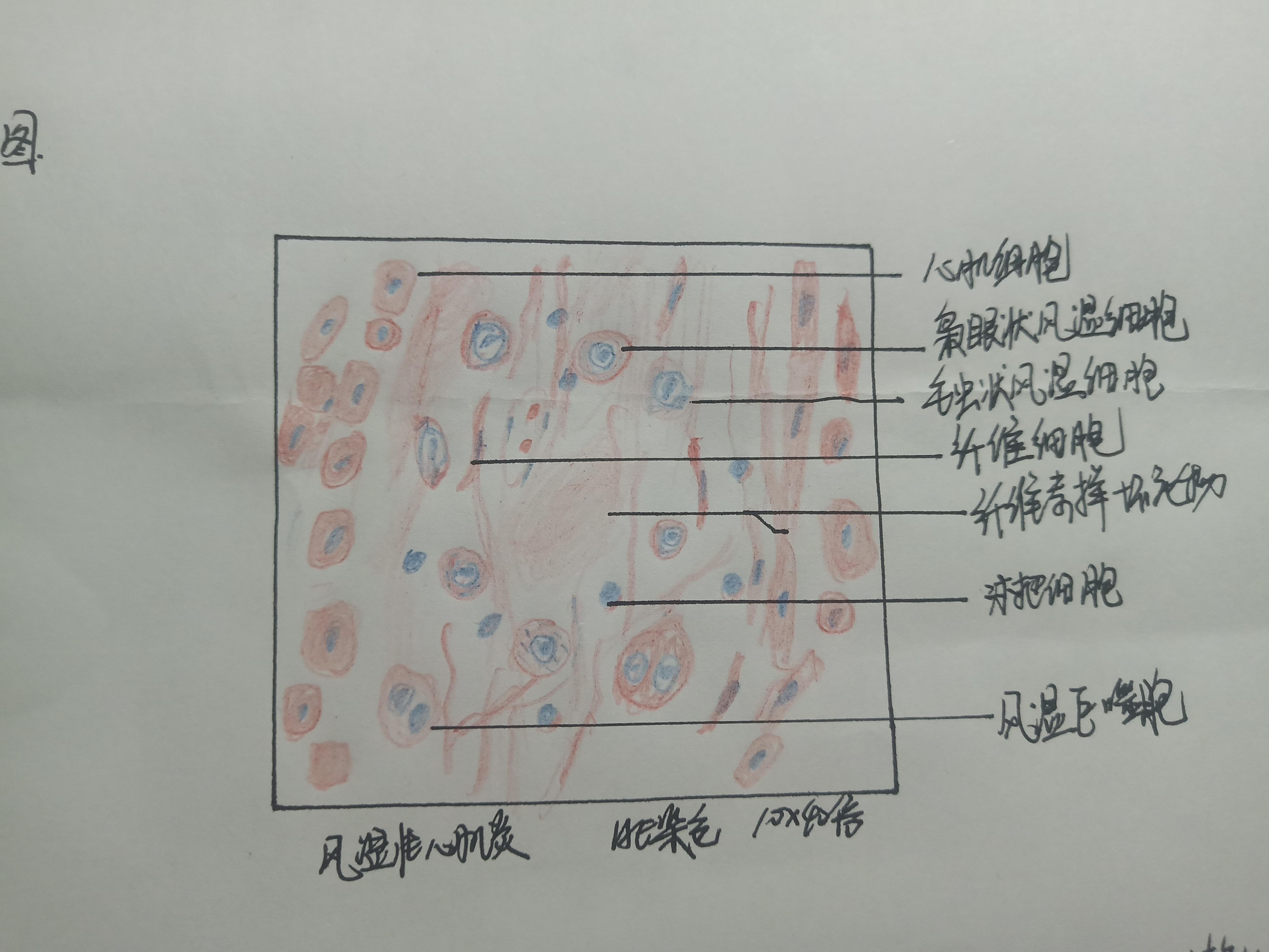 组胚,病理红蓝铅笔绘图 