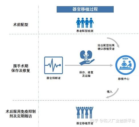 器官移植1——背景介绍：器官移植的“前世今生” - 知乎