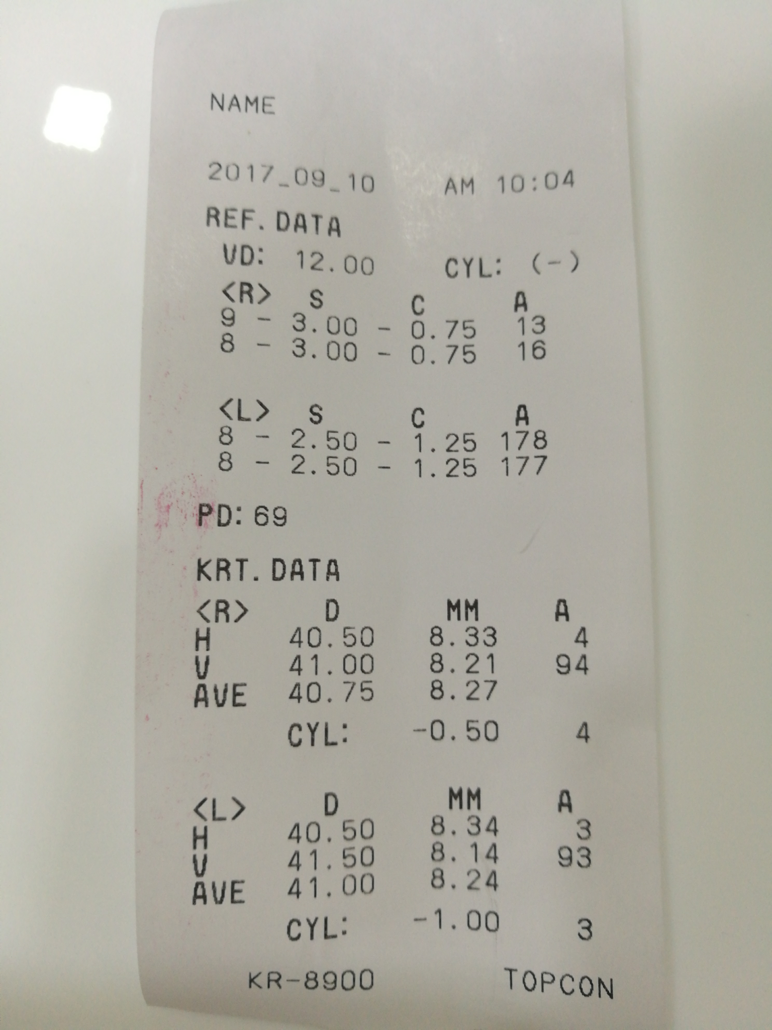 如何看懂电脑验光单!