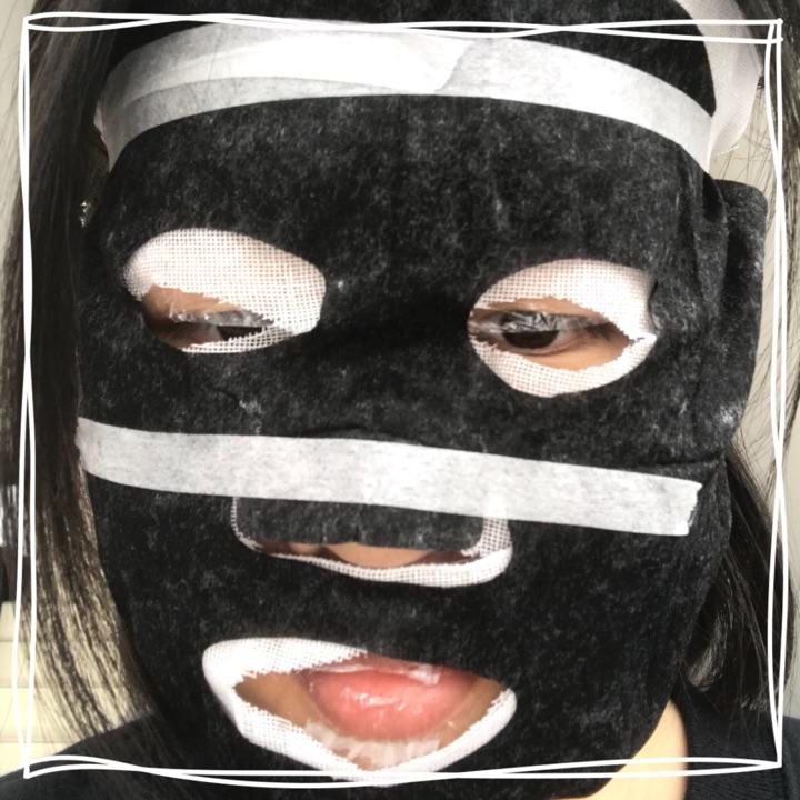 光动力治疗痤疮的效果好吗?