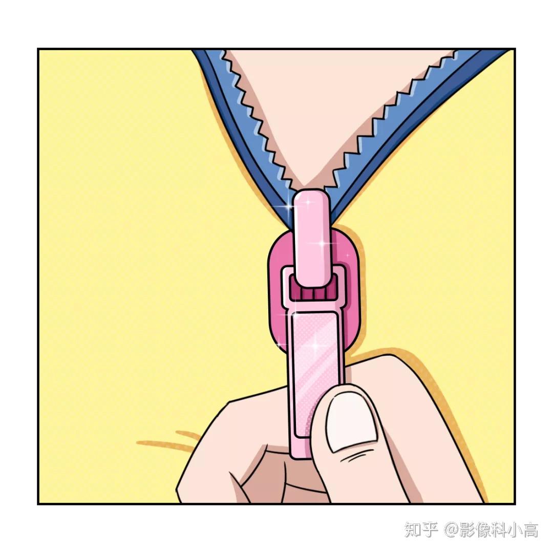 切开阴囊两侧的皮肤局部麻醉后结扎的过程小蝌蚪就会被锁在睾丸里从