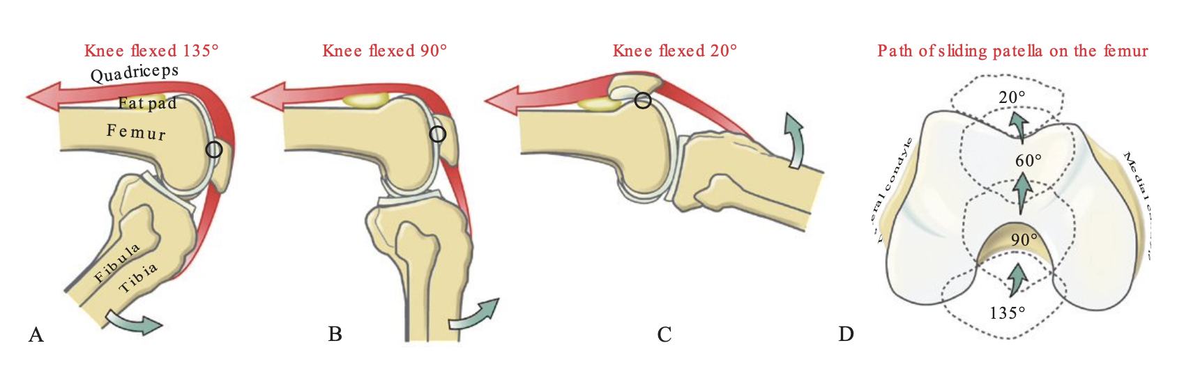 髌骨外移是如何产生的