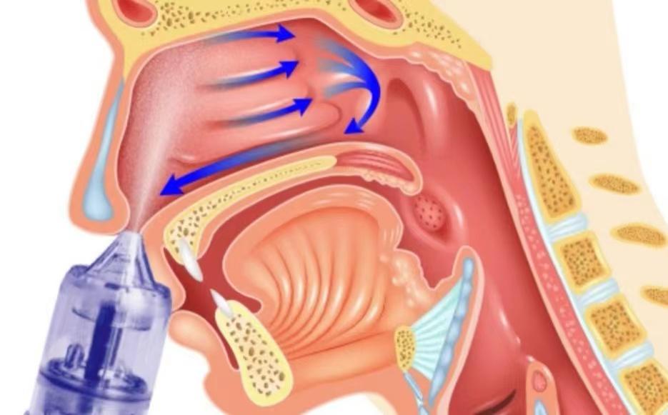 呼吸系統這麼多毛病原來是可以通過鼻腔護理緩解的