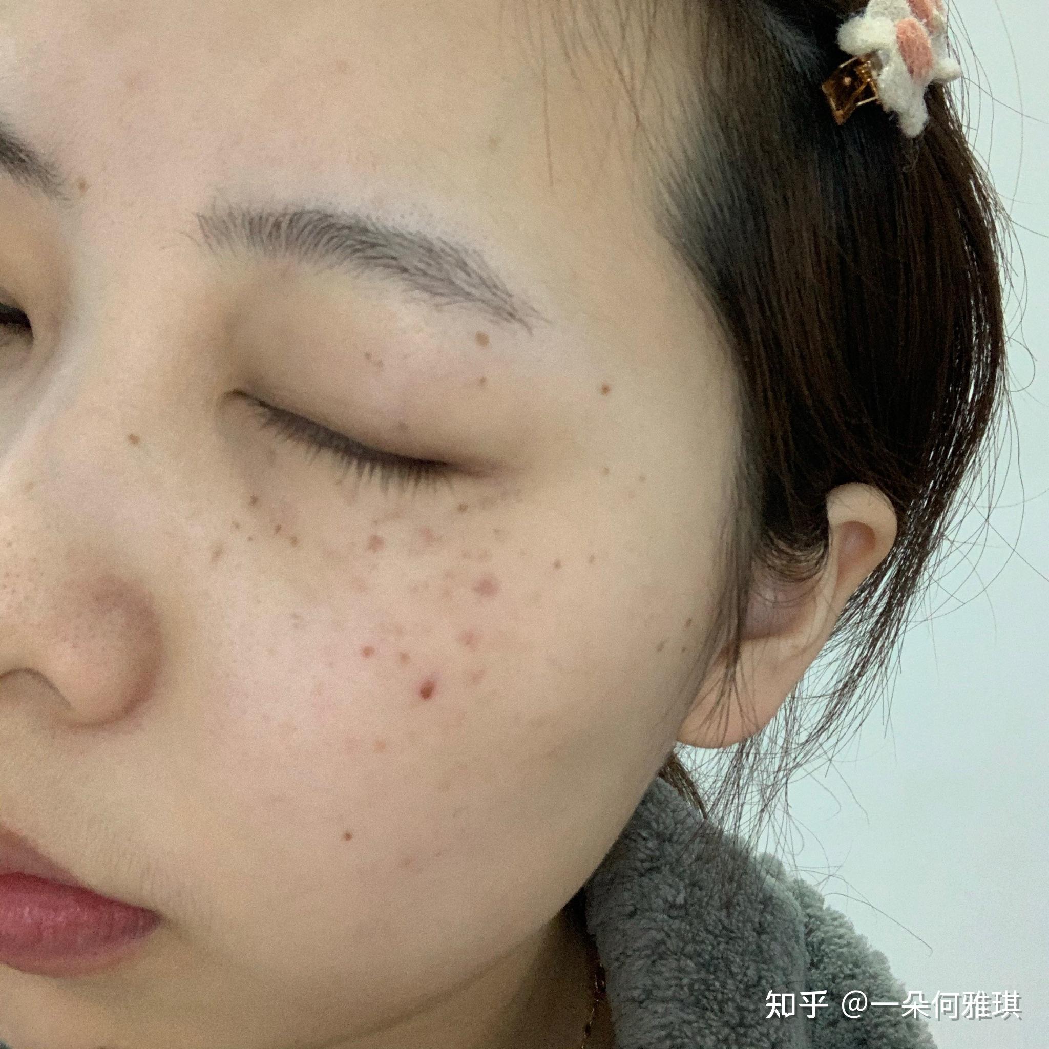 与斑战斗的十多年下