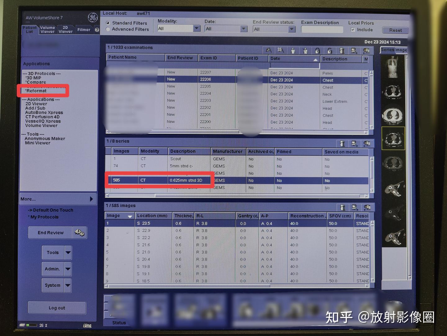 浅谈CT三维重建的操作方法 - 知乎