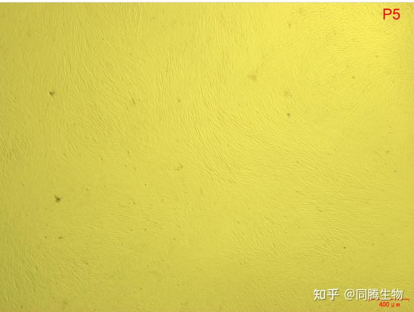 案例应用丨同腾新创msc培养基在间充质干细胞3d培养基中应用（上） 知乎 