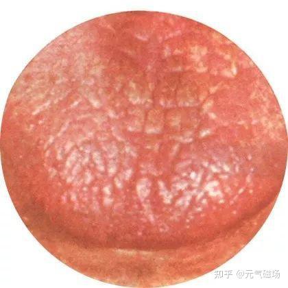 中医舌诊(三)高清版 - 知乎