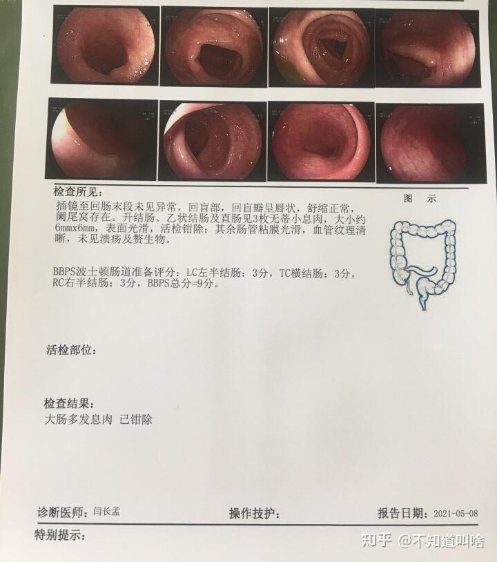 肠炎化验单图片