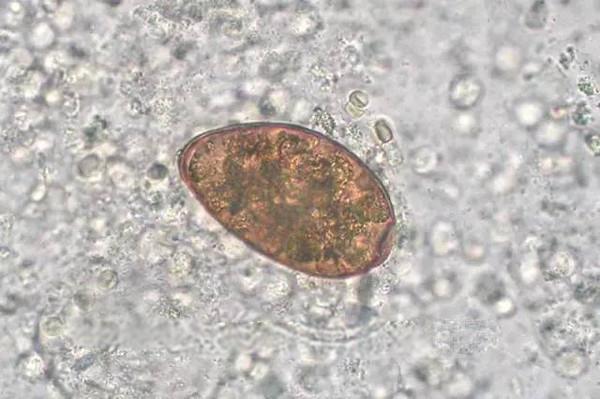 血吸虫卵显微镜图片
