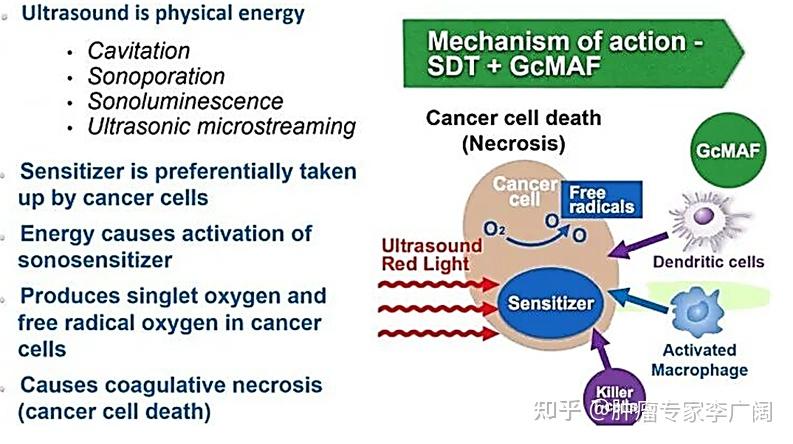 光动力、声动力、化学动力、光热疗法---新疗法简介 - 知乎