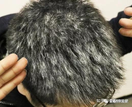 预防白发先了解白发生成原因! - 知乎