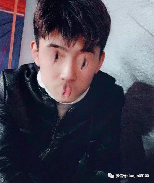 求大神把我的两个兔牙p掉 显得好看点 知乎