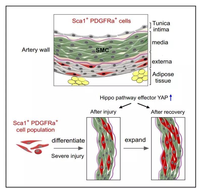 cellstemcell中科院发现血管平滑肌干细胞参与血管修复再生