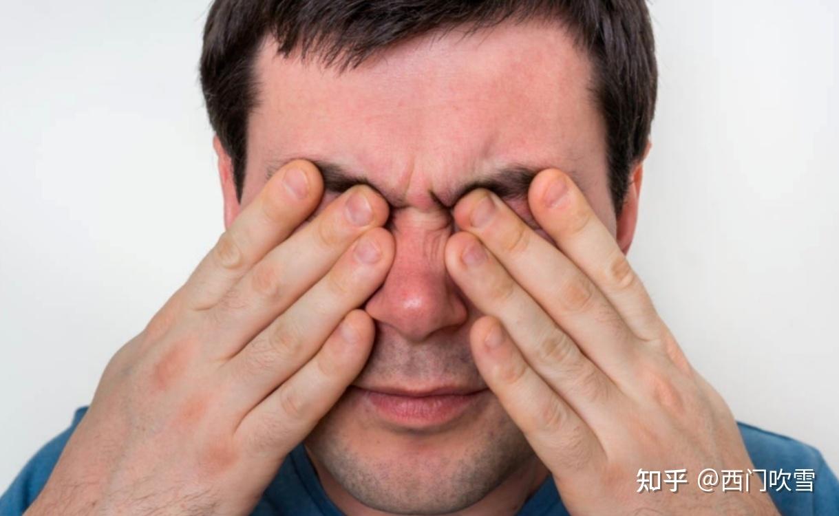 屏幕挂灯怎么选不踩坑?告别屏幕反光 + 眼干涩!2026年屏幕挂灯推荐:书客 SKR2 屏幕挂灯实测:熬夜工作不费眼,这次真没交智商税!