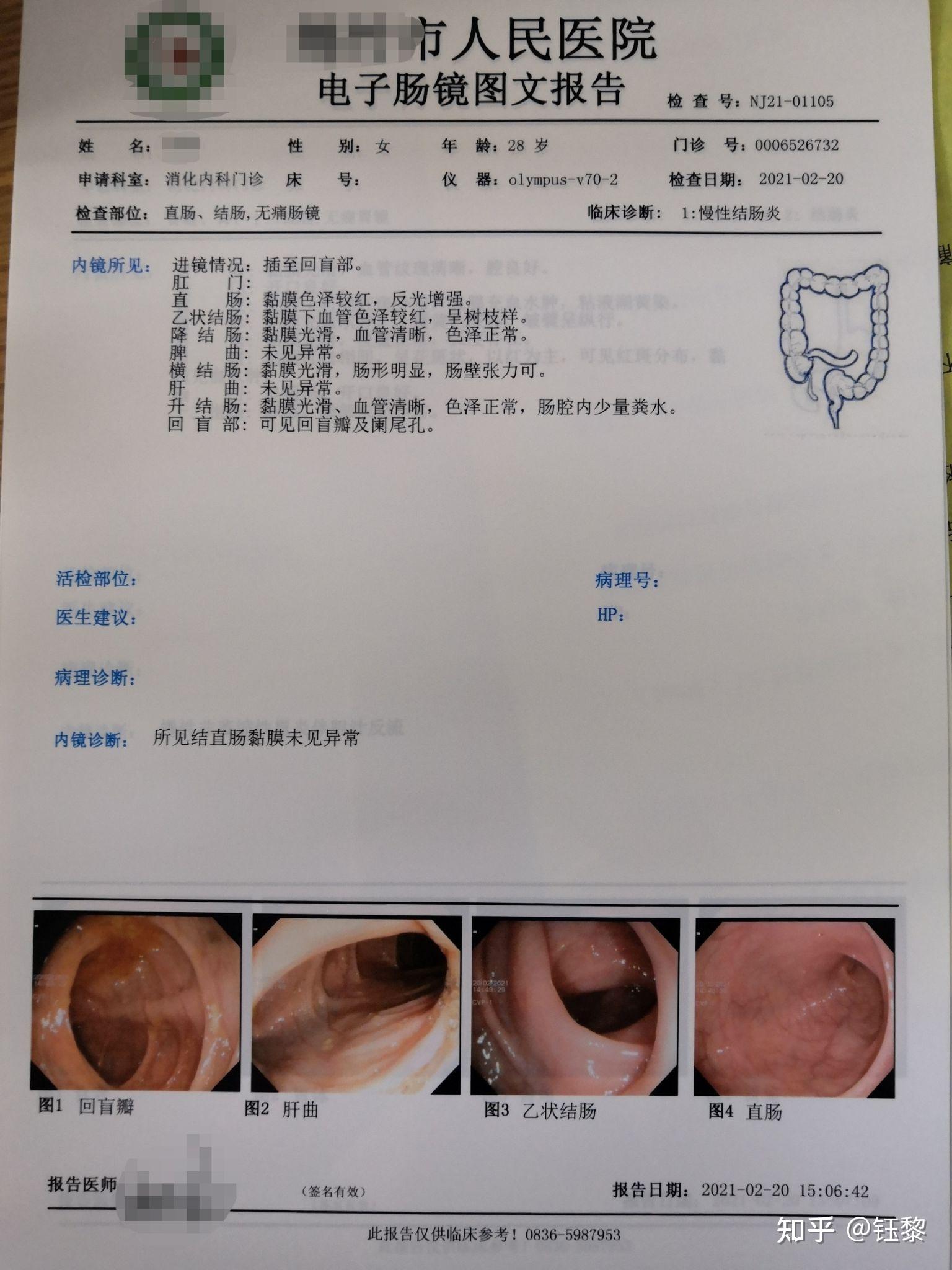 肠镜单子图片