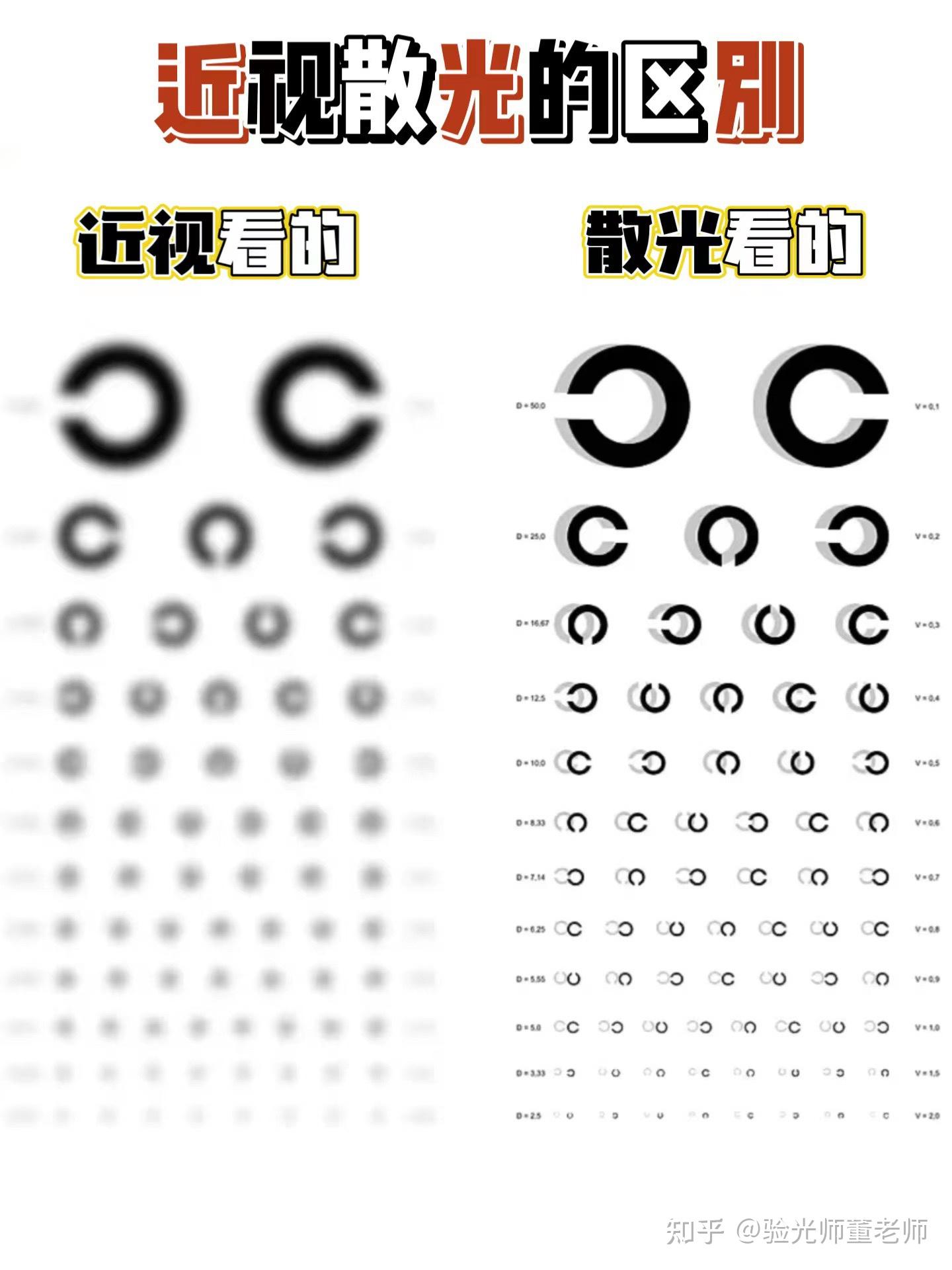 你对高度近视了解多少？近视大于600度，可能有致盲风险……|视网膜|白内障|青光眼|致盲|近视|-健康界