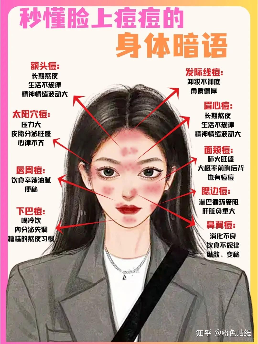 秒懂不同位置痘痘的原因