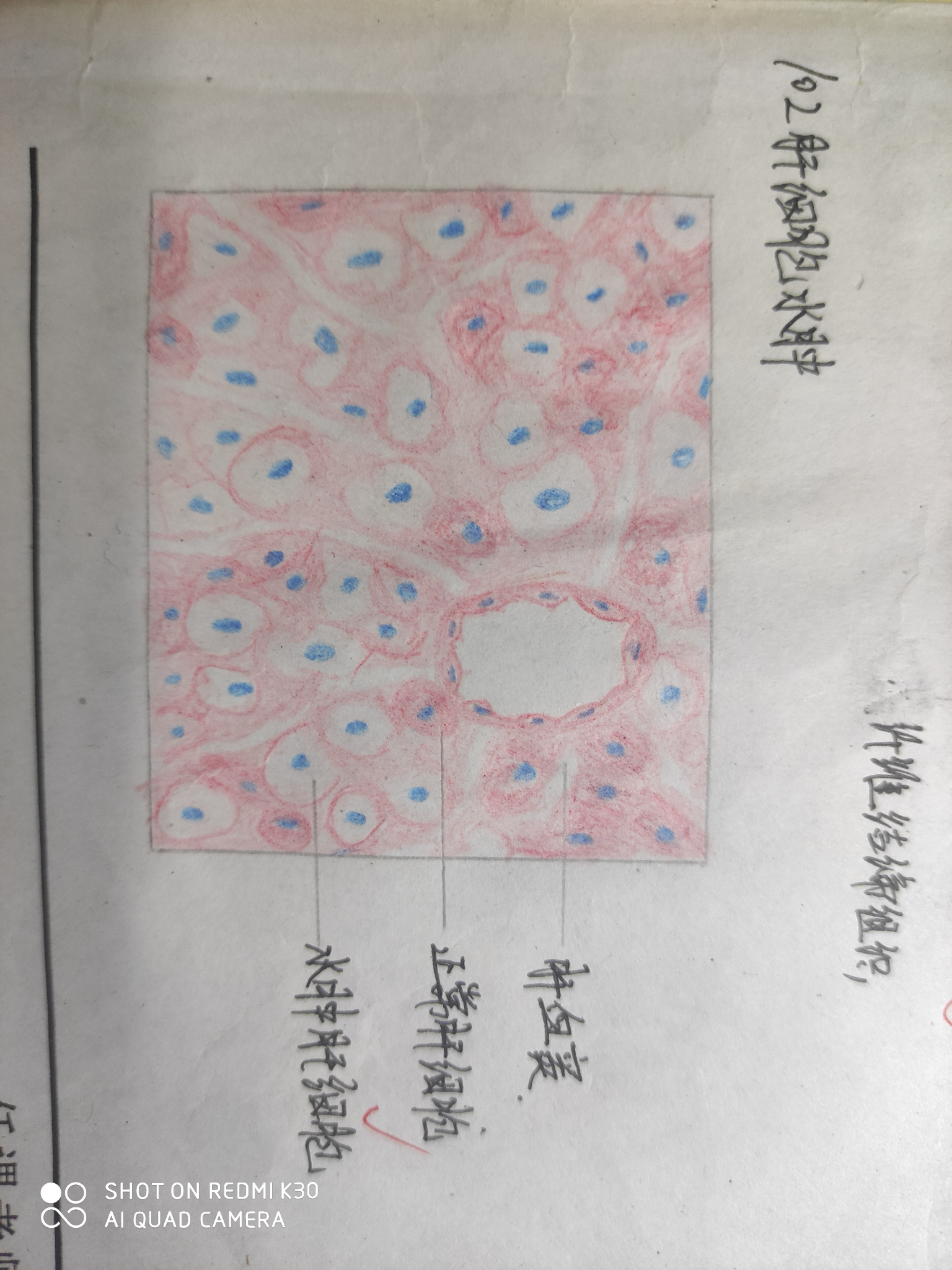 异物巨细胞红蓝铅笔图图片