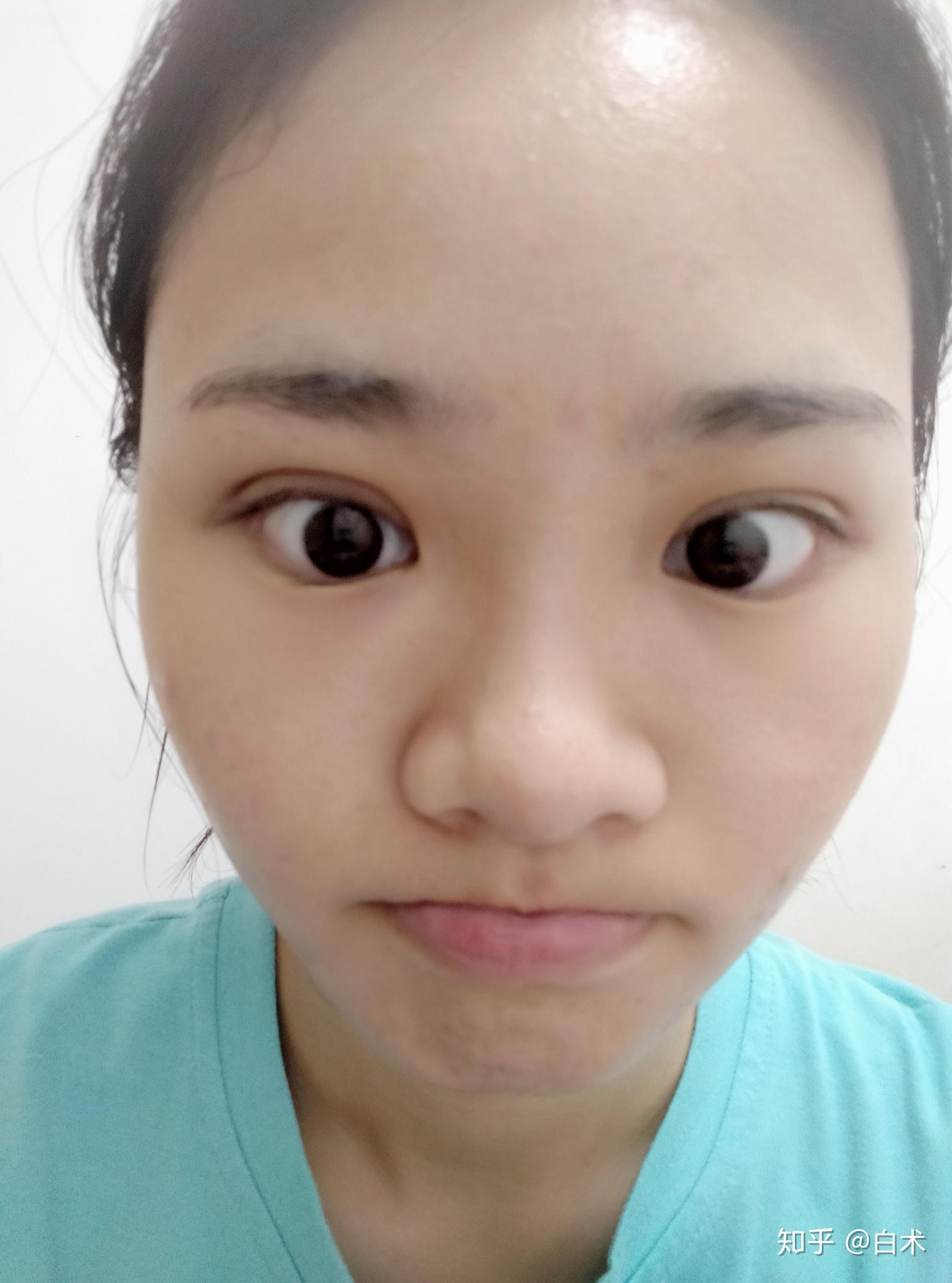 可以看看小姐妹们内双割的双眼皮的照片吗