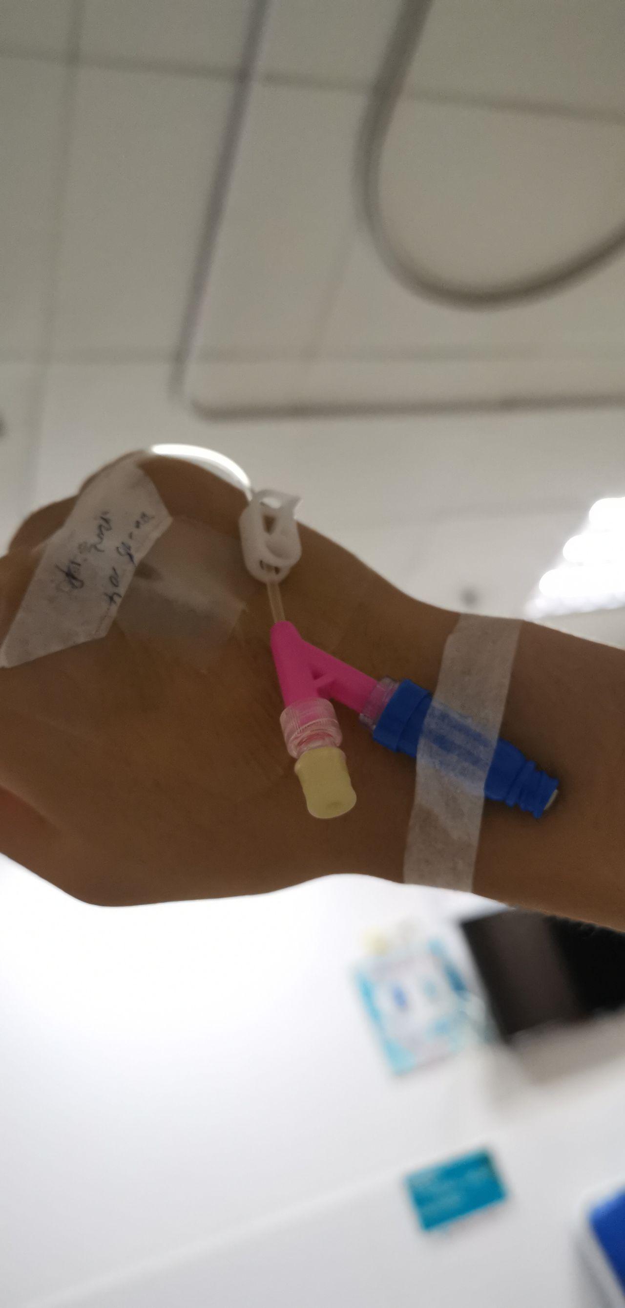 24岁,精索静脉曲张手术前后