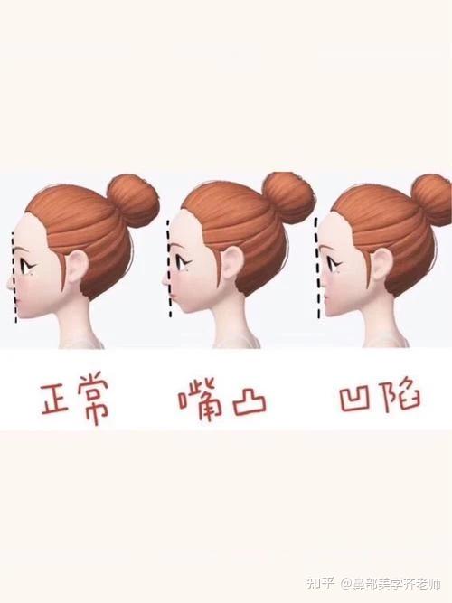凹脸必看 4种方法教你判断鼻基底是否凹陷 知乎 凹脸必看 4种方法教你判断鼻基底是否凹陷 知乎
