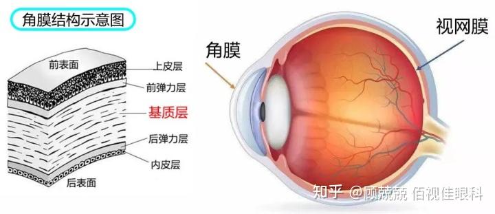 角膜激光类主要动的是角膜,角膜看着很薄,但其实它有5层结构