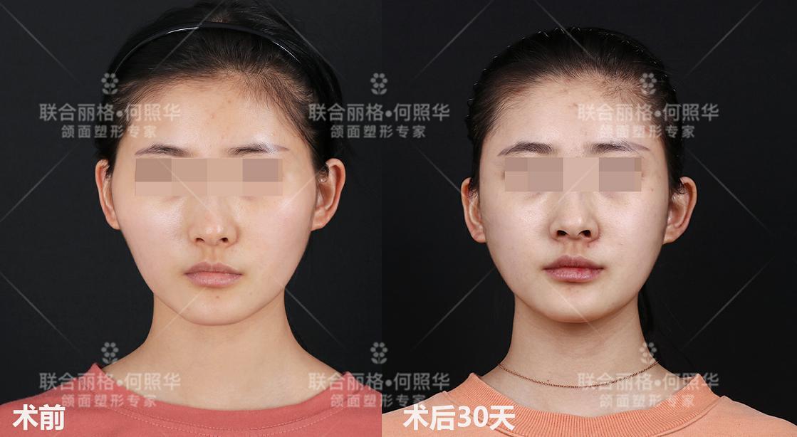 v2-e362f9b7d53af99cf97c9d9dbf0b94ff_1440w.jpg?source=172ae18b