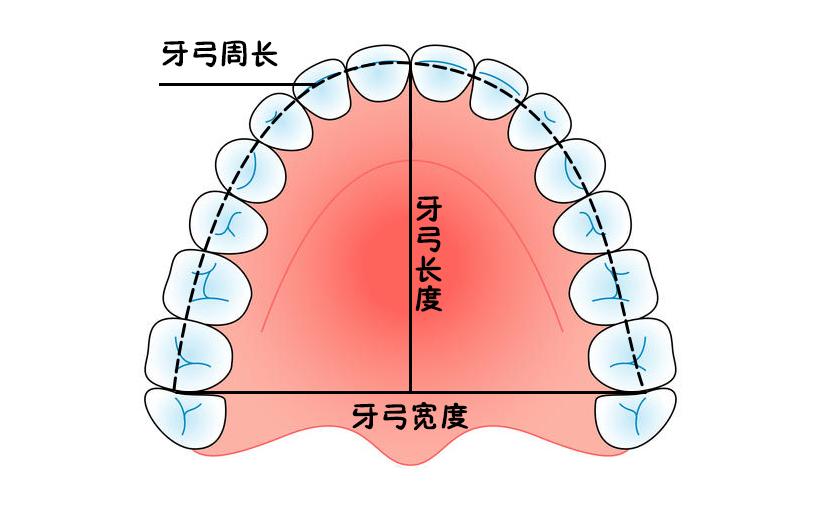 也就是现有的牙弓周长容纳不下牙弓内的所有牙齿.