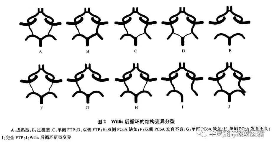 willis环丨最细解剖最全变异