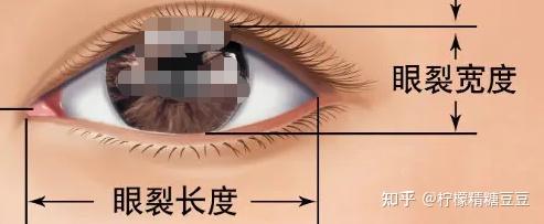 割双眼皮需要多少钱为什么割双眼皮有肉条双眼皮失败