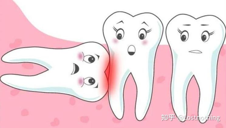 拔智齿到底多痛呢