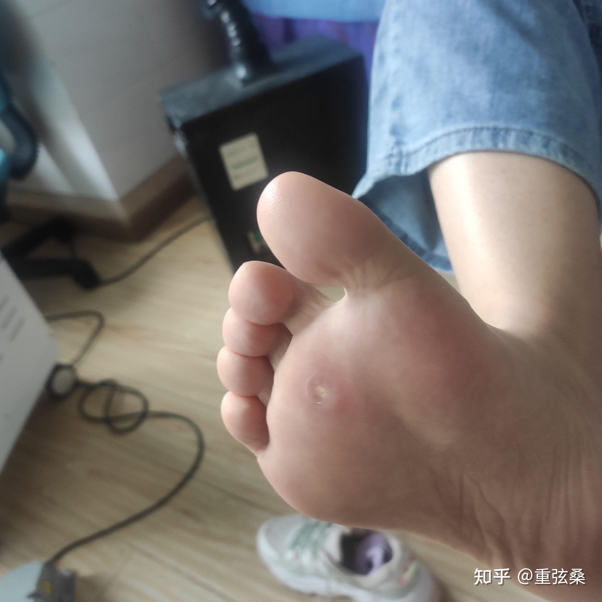 竹条抽脚底板图片