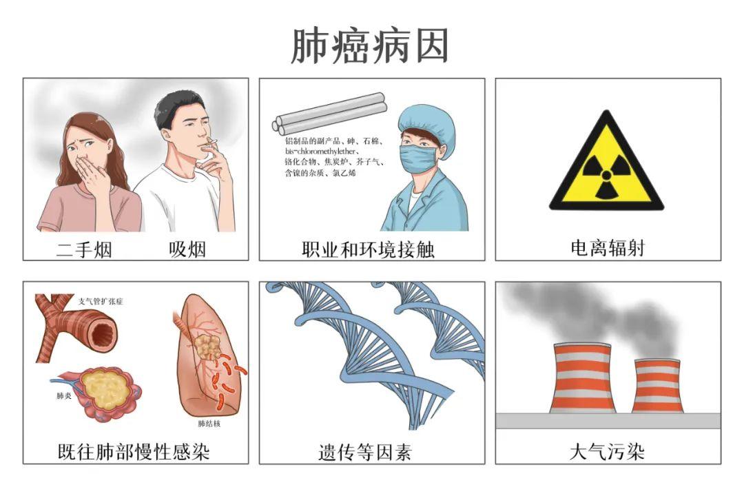 根據最新的專家共識,將我國肺癌高危人群定義為年齡≥40歲且具有以下