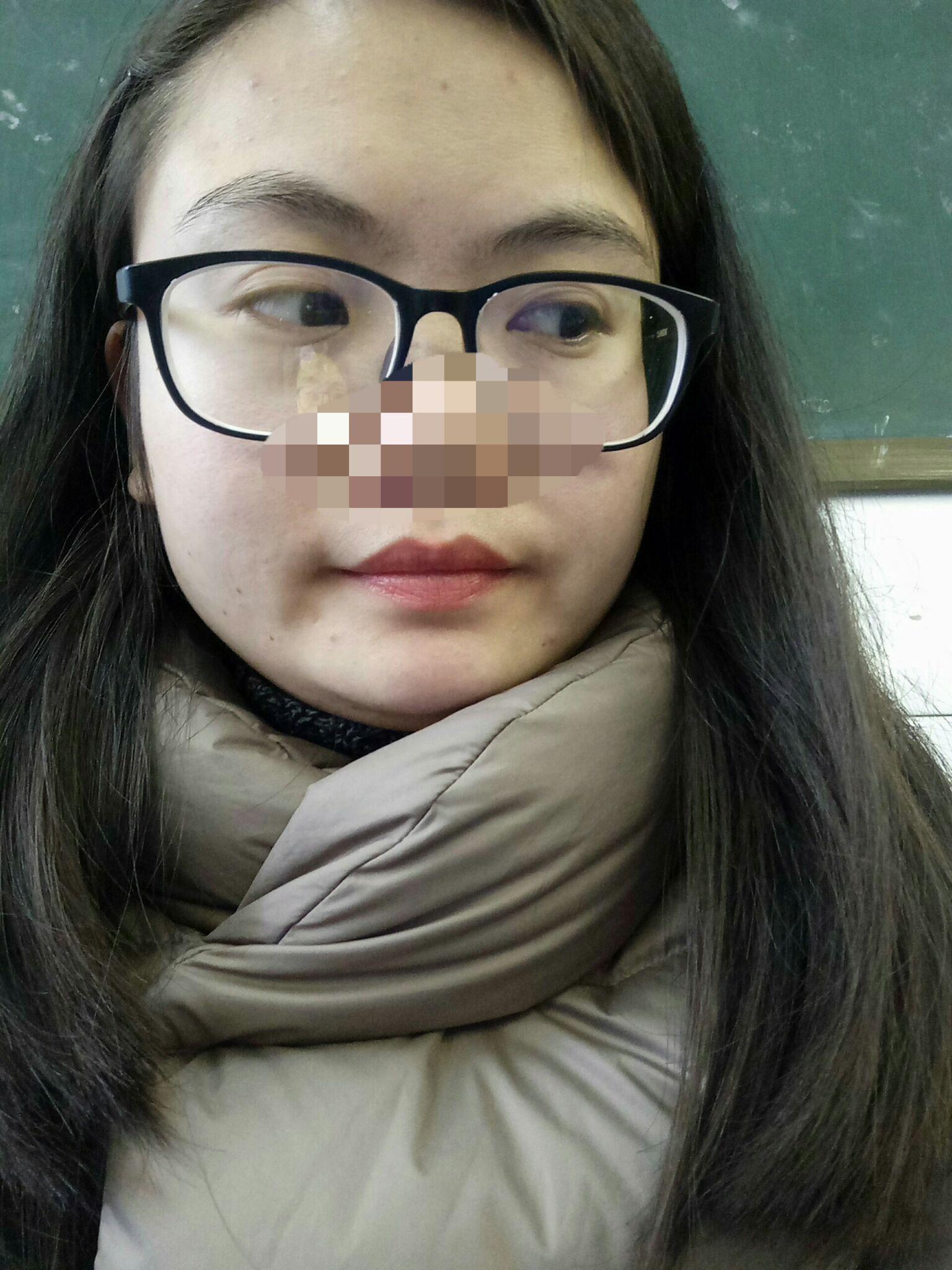 有没有因为鼻子不好看而毁了整张脸的例子