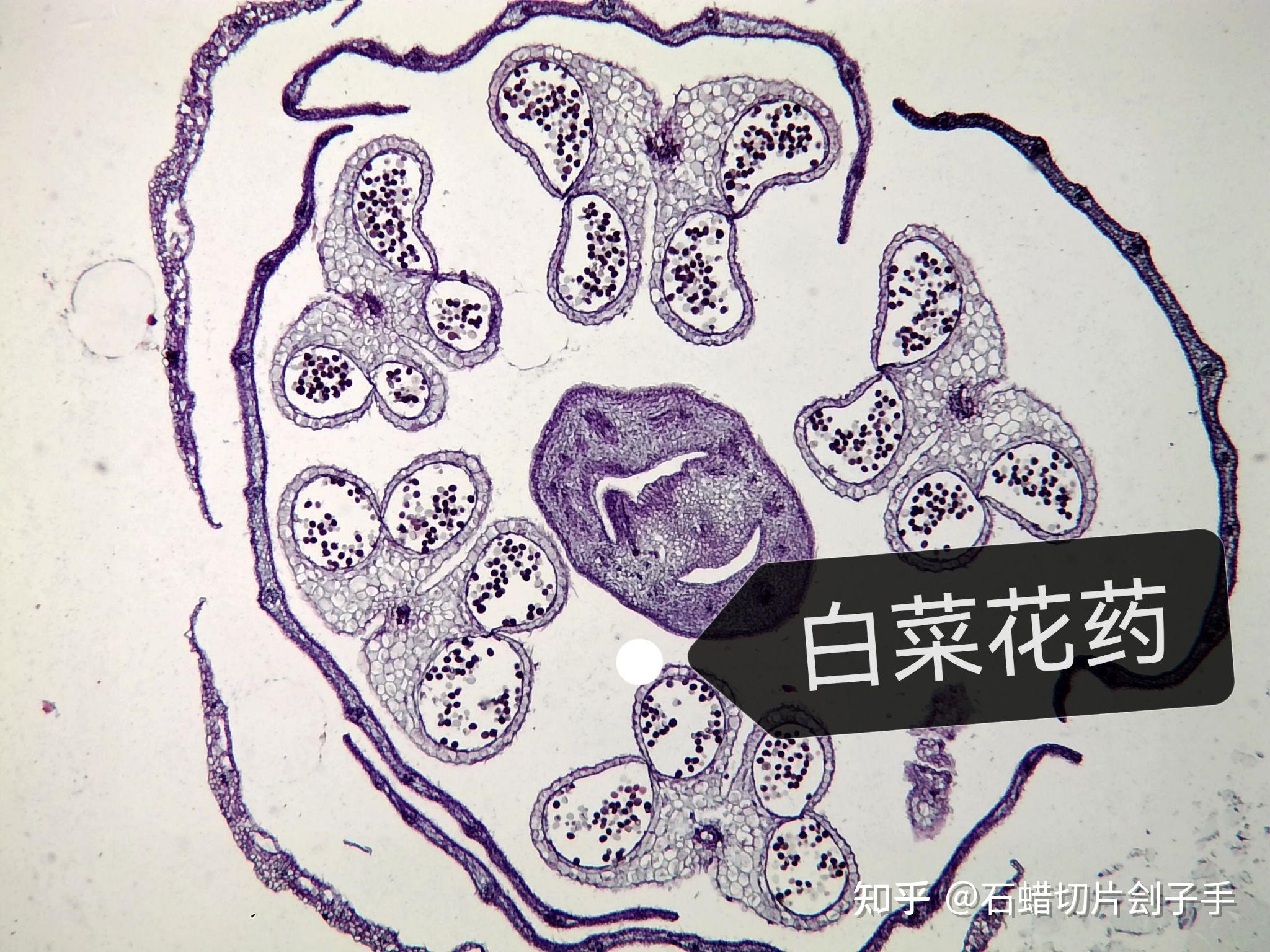 盘点我经手的石蜡切片
