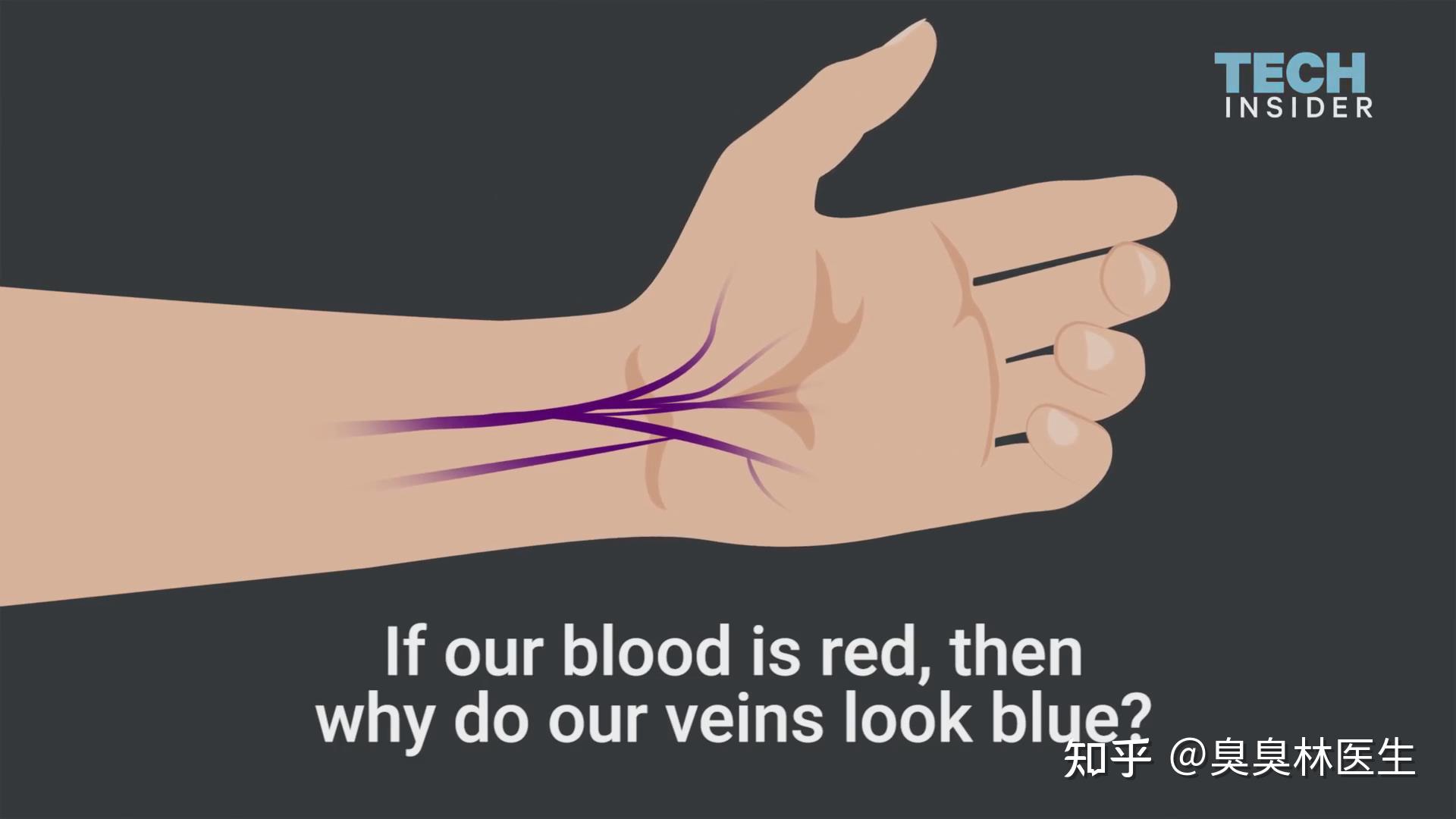 动脉出血图片 真实图片