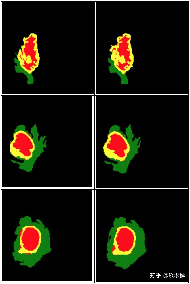 2D + Pytorch实现 知乎