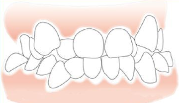 v2-e49c667c195b0821ec86417ee1b12d62_1440w.jpg?source=172ae18b