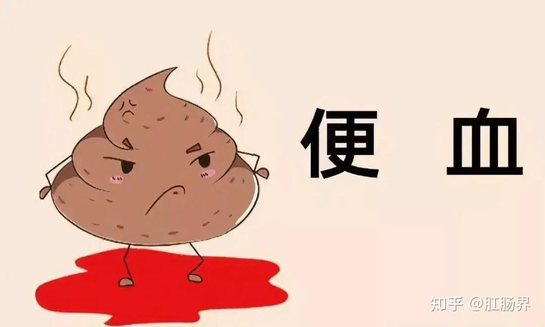 大便出血的4种情况 有一种都要警惕 - 知乎