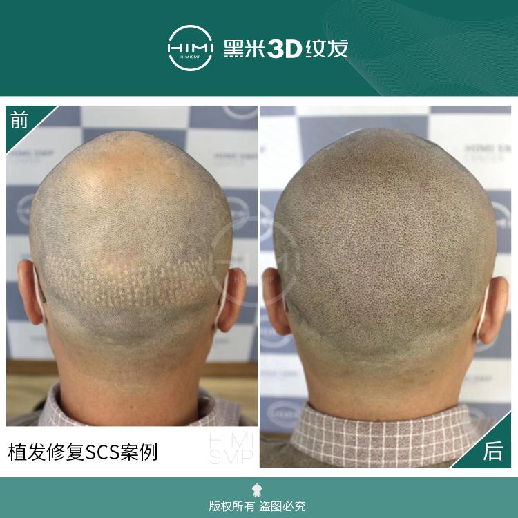 纹发知识科普：3d纹发有哪些应用？ - 知乎