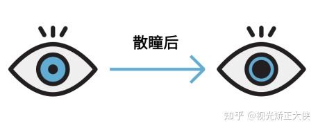 避坑防雷近視手術5分鐘檢查兩小時術前檢查原來這麼重要眼科醫生手