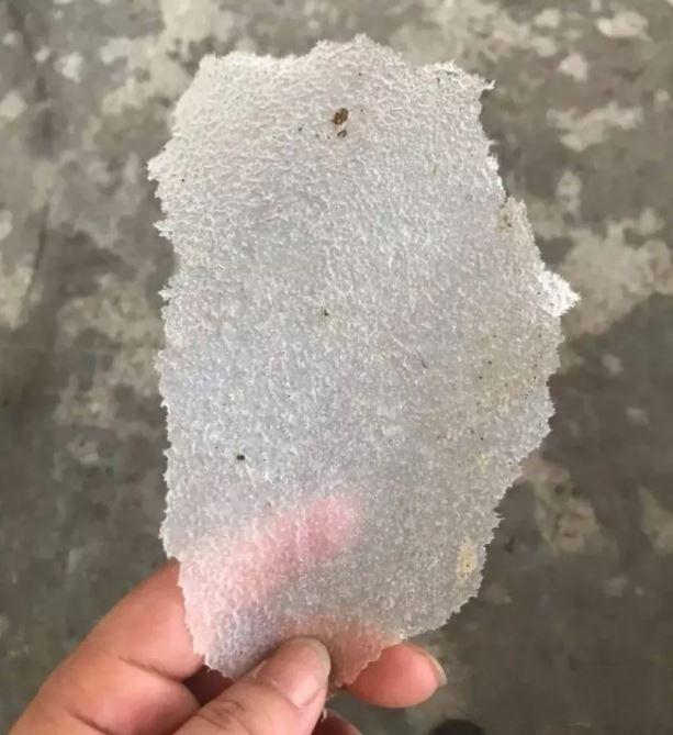 见过的最大头皮屑多大